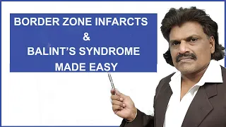 BORDER ZONE INFARCTS & BALINT'S SYNDROME MADE EASY