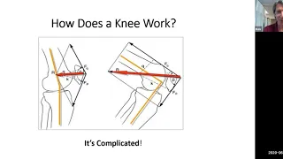 Prehab and Rehab for Knee Replacement Surgery: What You Should Know