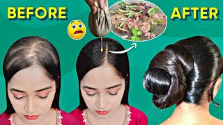 Ganje Sar Par Baal Ugane Ka Zabardast Ayurvedic Nuskha 👉I Used This on Bald Scalp for 3X Hairgrowth