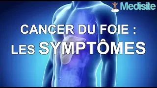 Comment reconnaître les signes d'un cancer du foie ?