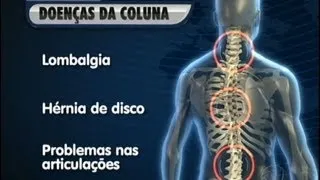 Dores na coluna atingem 54 milhões de brasileiros