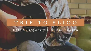 Trip To Sligo: Celtic Fingerstyle Guitar Lesson