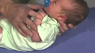 Moro Reflex