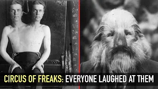 Circus freaks: stories and tragedies of circus freaks