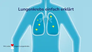 Lungenkrebs – Was heißt das eigentlich?