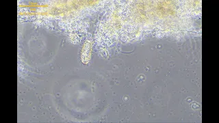 4K活性汚泥の微生物　コレプス（Coleps）の繊毛動