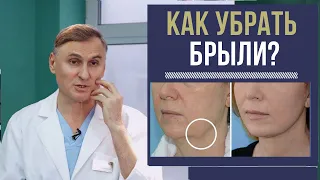 👍🔥КАК УБРАТЬ БРЫЛИ: БЕЗОПЕРАЦИОННЫЕ МЕТОДЫ И ПЛАСТИКА