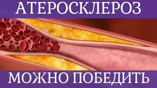 ❤ Как победить атеросклероз