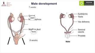 Pathophysiology of Disorder of Sexual Development