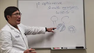 Optic Nerve Sheath Meningioma