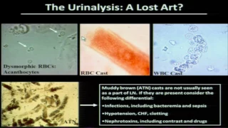 The Management of Lupus Nephritis: A Nephrologist's Perspective