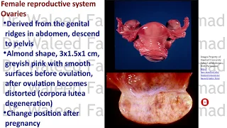 PVS 8 Female reproductive system Part 1
