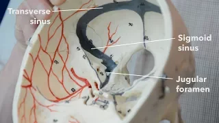 Dural venous sinuses