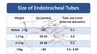 Endotracheal Intubation | Pediatrics