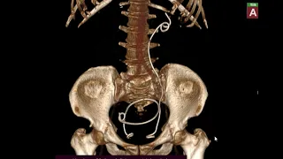 Complex case , can you solve it ? case interpretation session