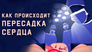 Edu: Как происходит пересадка сердца