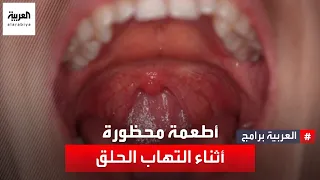 ما هي الأطعمة التي يجب الابتعاد عنها عند التهاب الحلق؟