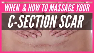 C-Section Scar Tissue Massage When To Start (& WHAT TO DO IF YOU ARE AFRAID TO TOUCH YOUR SCAR)