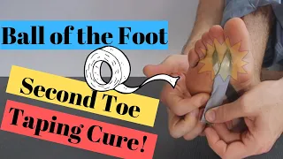 2nd Toe Pain Capsulitis & Ball of Foot Taping [2022 Home Treatment]