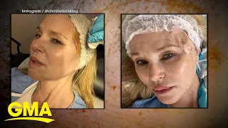 Christie Brinkley reveals skin cancer diagnosis