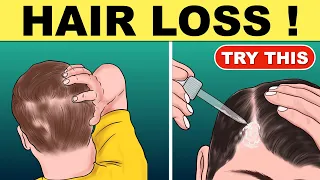 Hair fall Treatment | Home Remedies for Hair fall | Hair fall Solution