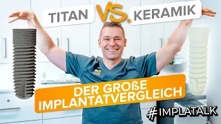 Titanimplantat oder Keramikimplantat? Der Grosse Vergleich inkl. Pros und Cons ✅