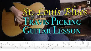 St. Louis Blues - Chet Atkins (With Tab) | Watch & Learn Travis Picking Guitar Lesson