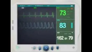 EKG/ECG Monitor animation Lop