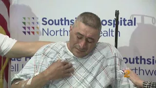 Man Describes Being Struck By Lightning