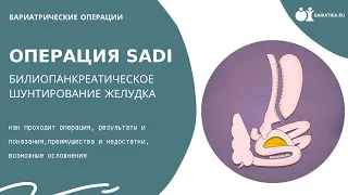 Операция SADI (САДИ) - билиопанкреатическое шунтирование желудка