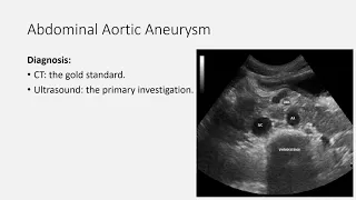 Vascular Emergencies Summary for MRCEM intermediate SBA