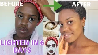 How I How i BRIGHTENED MY SKIN IN 6 DAYS| REALISTIC and Natural way to reduce hyperpigmentation