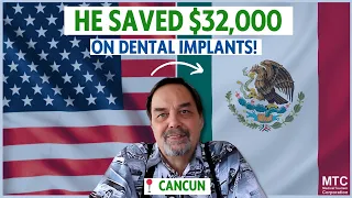 Review – Dental Implants in Cancun, Mexico