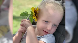 Pierre Robin Sequence and Cleft Palate, The Children's Hospital of Buffalo Foundation