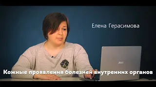 Кожные проявления болезней внутренних органов