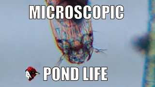 Microscopic Pond Life - Biodiversity Shorts #10