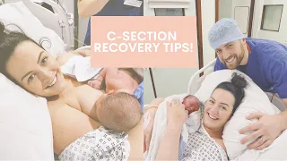 C-Section recovery tips! | Planned Caesarean