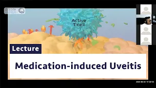 Medication-Induced Uveitis