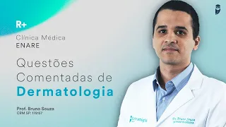 Questões de Dermatologia das provas de Residência Médica - R+ Clínica Médica ENARE