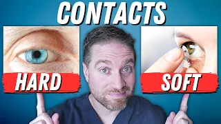 Hard (RGP) VS Soft Contact Lenses - Pros and Cons!