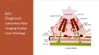 Autoimmune Hepatitis in Children: Approach to Treatment and What to Expect