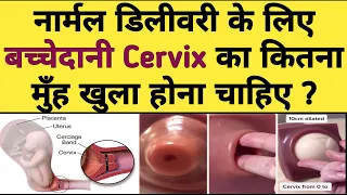 नॉर्मल डिलीवरी के लिए बच्चेदानी Cervix का कितना मुंह खुला होना चाहिए ? Symptoms Of Normal Delivery.