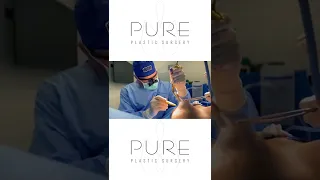 Dr.Earle performing his featured Case of the Day, Breast Augmentation! Comment below