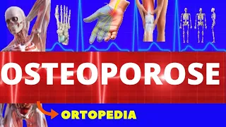 OSTEOPOROSE - O QUE É, CAUSAS, SINTOMAS, DIAGNÓSTICO E TRATAMENTO - ORTOPEDIA