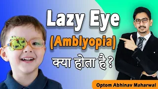 What is Amblyopia (Lazy Eye)? || Lazy Eye Treatment || What is Amblyopia? || Lazy Eye Exercise