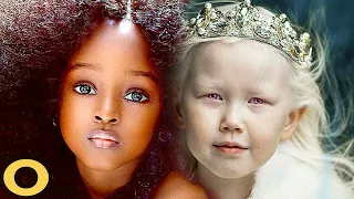 10 Most Unique Kids Who are One In a Million