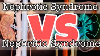 Nephrotic vs Nephritic Syndrome|Kidney Diseases| E-Learn with Zakir