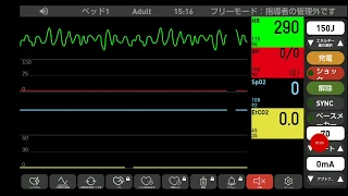 心電図モニター シュミレーション　心室細動V FIB→心拍再開