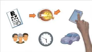 Wet Age-Related Macular Degeneration (wet AMD) Explained