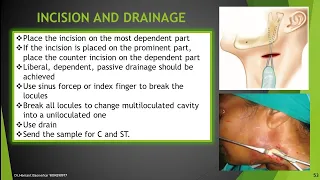 Incision Drainage Case Report